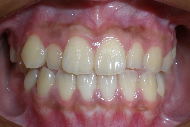 江西吉安县大力推进教育扶贫“三个全覆盖”|太阳成tyc7111cc(图1) 太阳成tyc7111cc